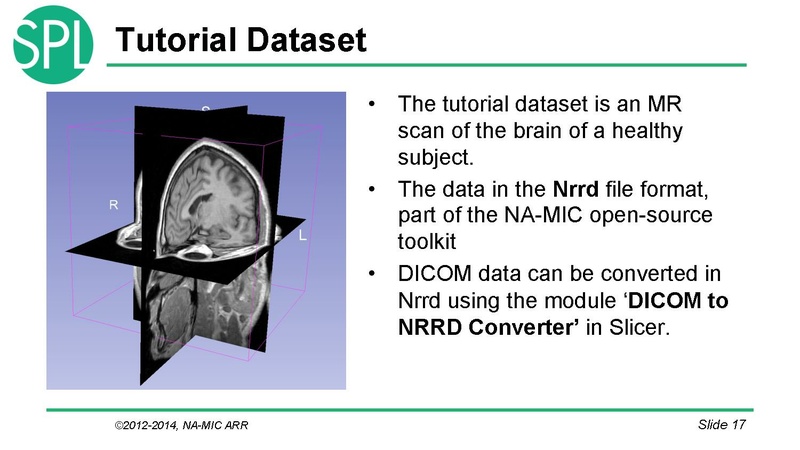 File:DataLoadingAndVisualizationSlicer4.1 SoniaPujol.pdf