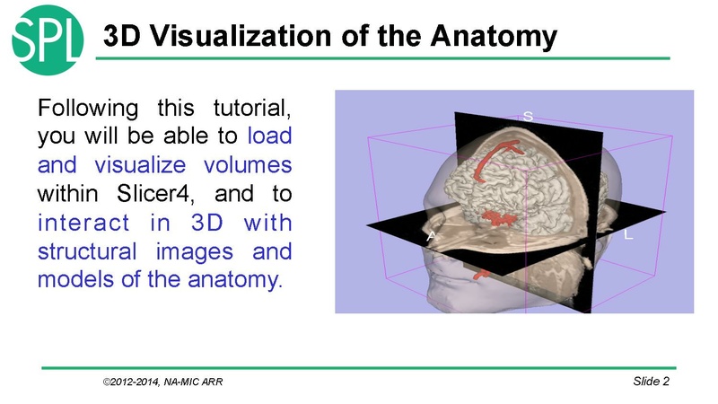 File:DataLoadingAndVisualizationSlicer4.1 SoniaPujol.pdf