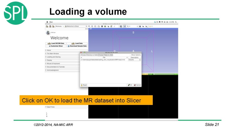 File:DataLoadingAndVisualizationSlicer4.1 SoniaPujol.pdf