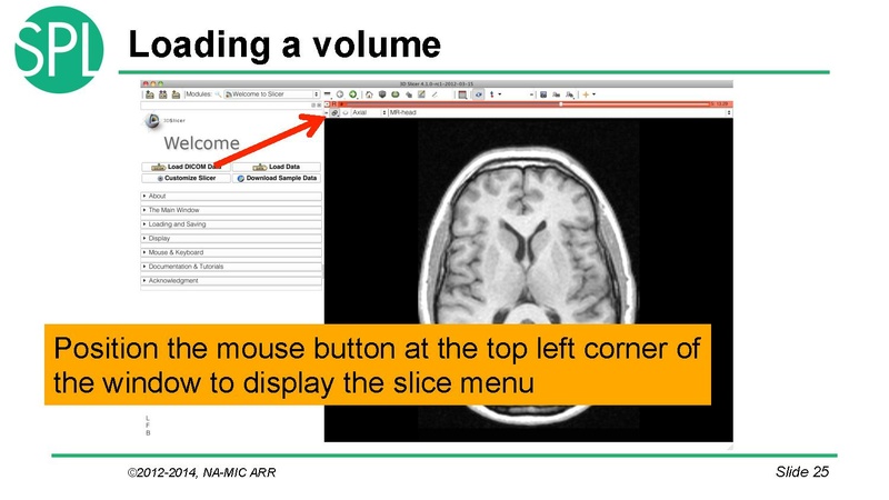 File:DataLoadingAndVisualizationSlicer4.1 SoniaPujol.pdf