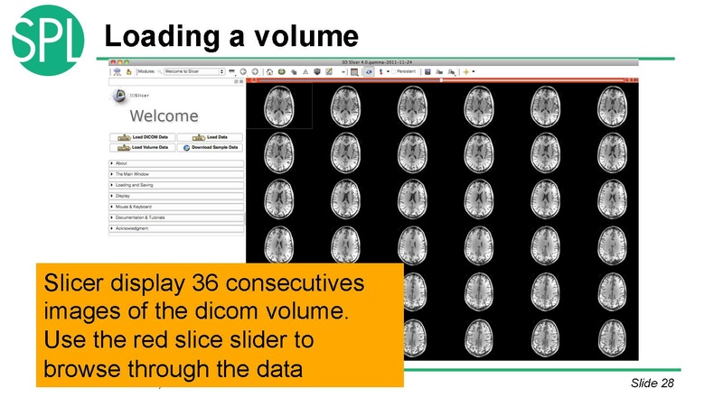 File:DataLoadingAndVisualizationSlicer4.1 SoniaPujol.pdf