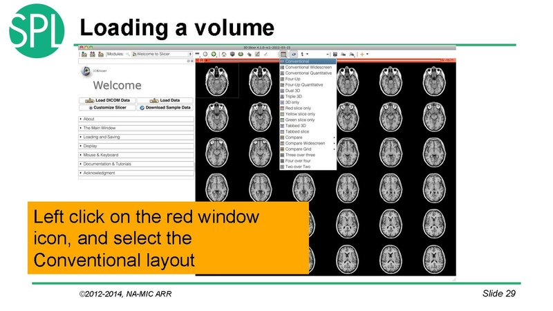 File:DataLoadingAndVisualizationSlicer4.1 SoniaPujol.pdf