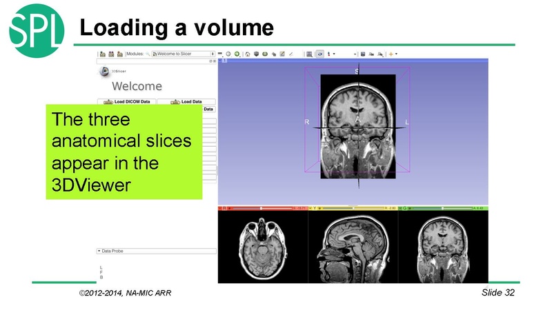 File:DataLoadingAndVisualizationSlicer4.1 SoniaPujol.pdf
