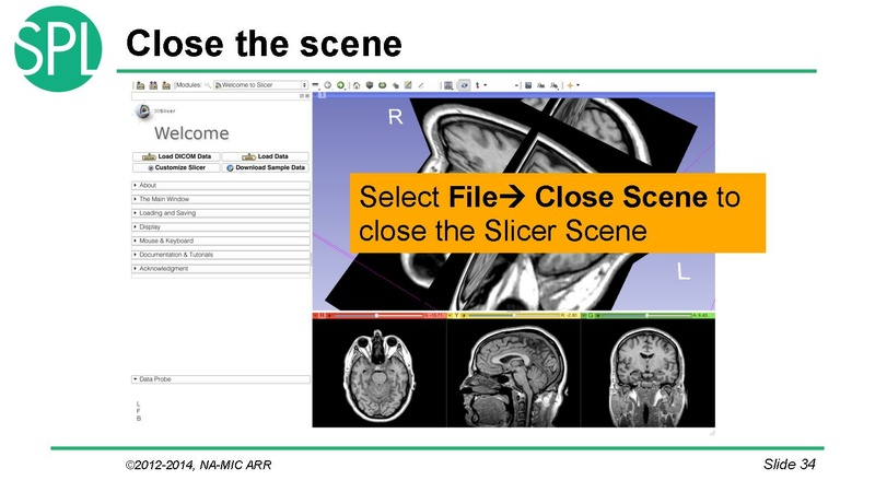 File:DataLoadingAndVisualizationSlicer4.1 SoniaPujol.pdf
