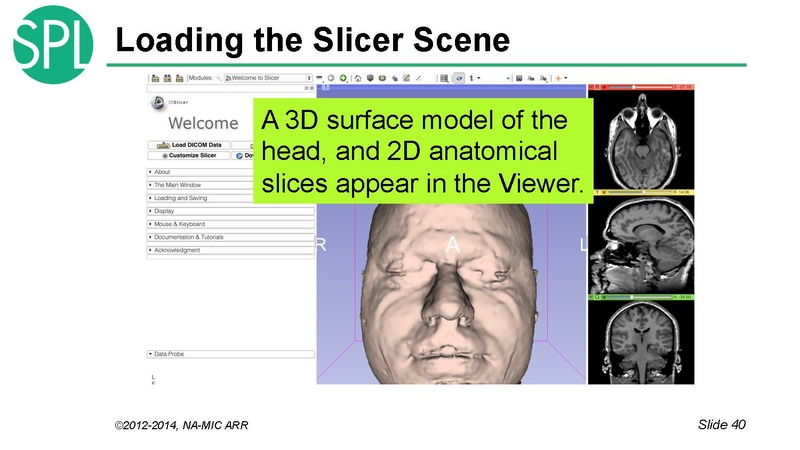 File:DataLoadingAndVisualizationSlicer4.1 SoniaPujol.pdf