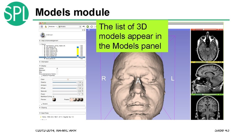 File:DataLoadingAndVisualizationSlicer4.1 SoniaPujol.pdf