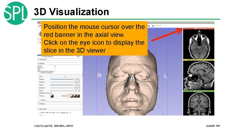 File:DataLoadingAndVisualizationSlicer4.1 SoniaPujol.pdf