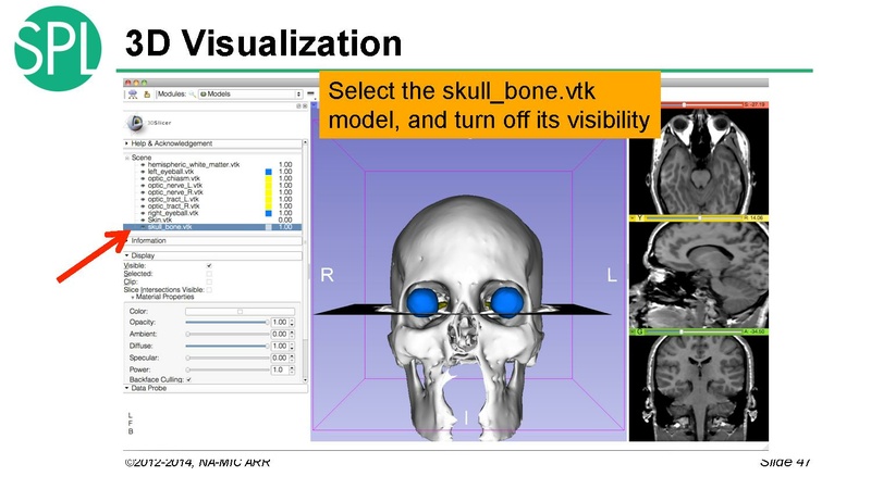 File:DataLoadingAndVisualizationSlicer4.1 SoniaPujol.pdf