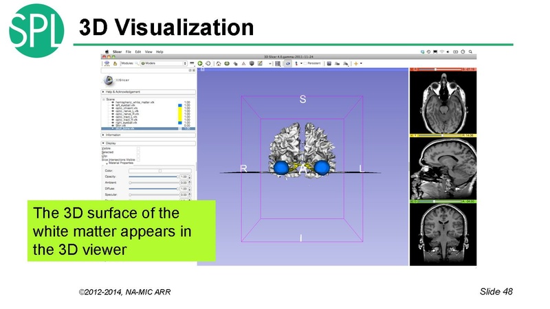 File:DataLoadingAndVisualizationSlicer4.1 SoniaPujol.pdf