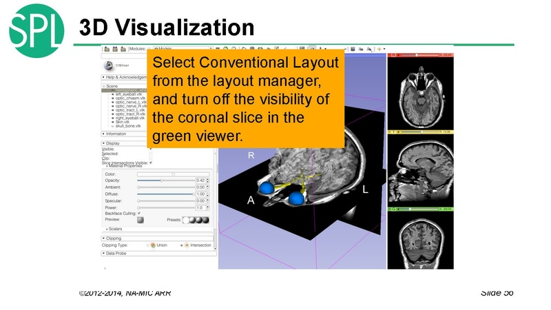 File:DataLoadingAndVisualizationSlicer4.1 SoniaPujol.pdf