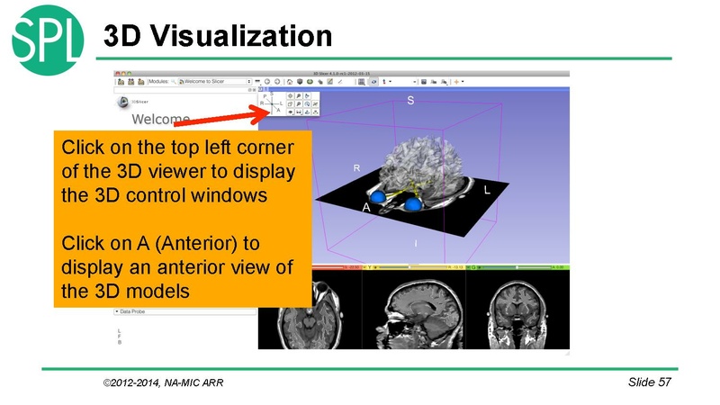 File:DataLoadingAndVisualizationSlicer4.1 SoniaPujol.pdf