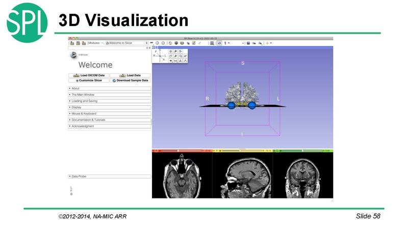 File:DataLoadingAndVisualizationSlicer4.1 SoniaPujol.pdf