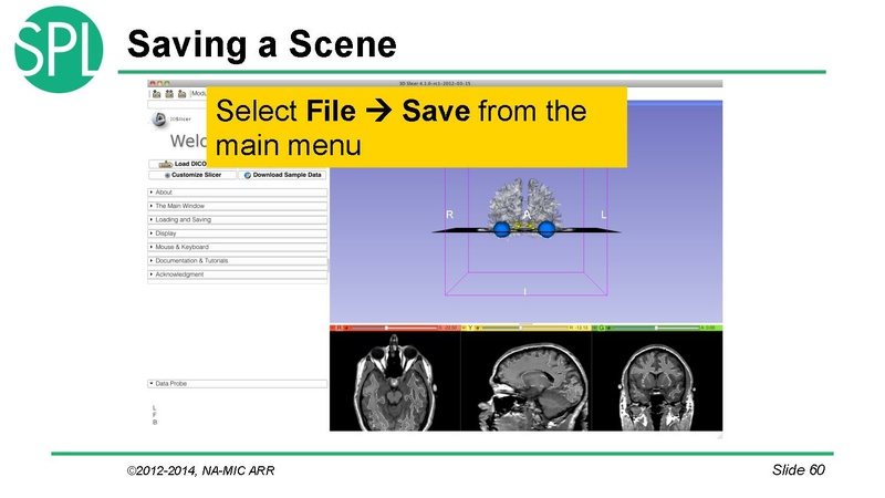 File:DataLoadingAndVisualizationSlicer4.1 SoniaPujol.pdf