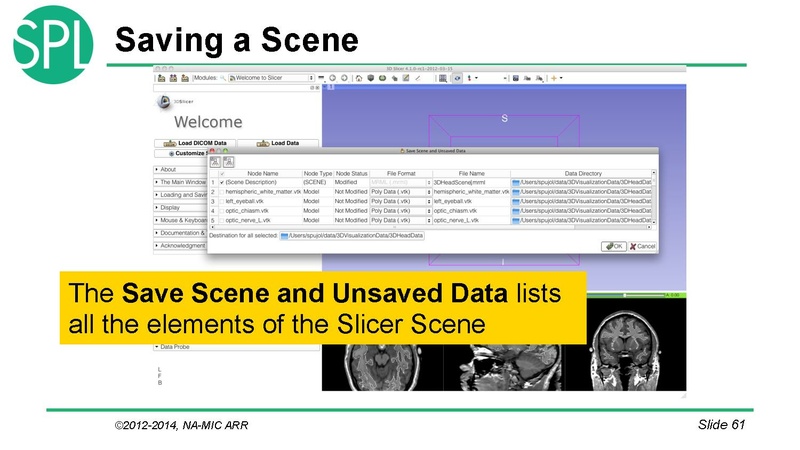 File:DataLoadingAndVisualizationSlicer4.1 SoniaPujol.pdf