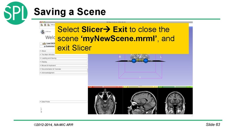 File:DataLoadingAndVisualizationSlicer4.1 SoniaPujol.pdf