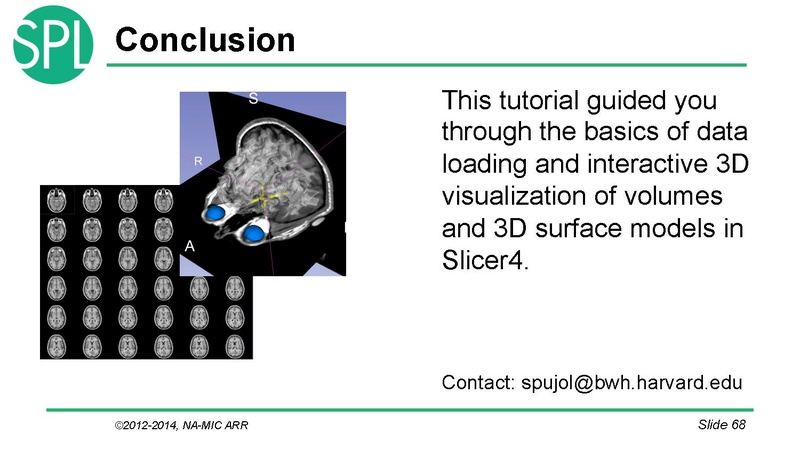 File:DataLoadingAndVisualizationSlicer4.1 SoniaPujol.pdf