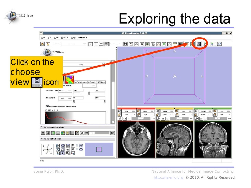 File:3DDataLoadingAndVisualization Slicer3.6 SoniaPujol.pdf