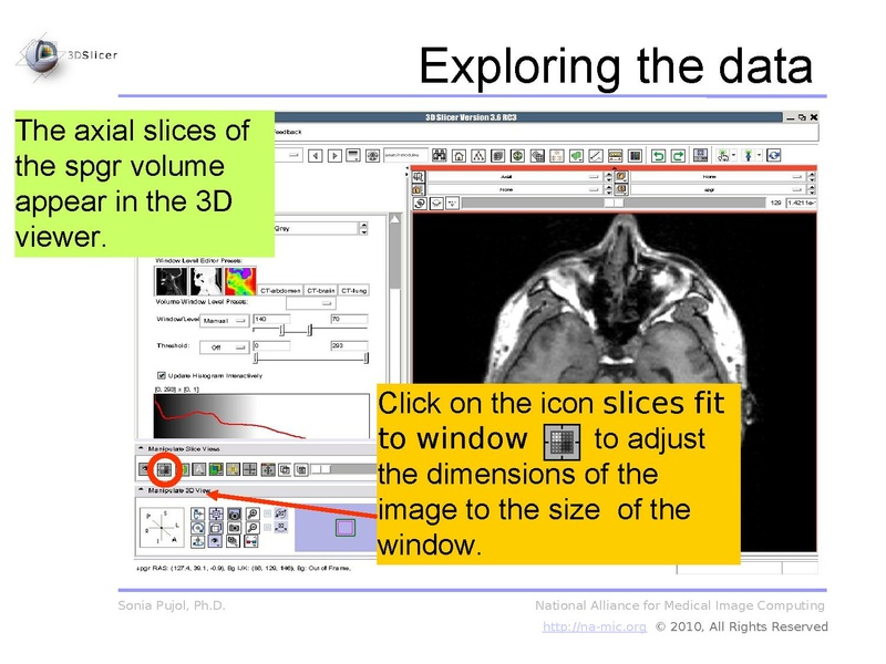 File:3DDataLoadingAndVisualization Slicer3.6 SoniaPujol.pdf