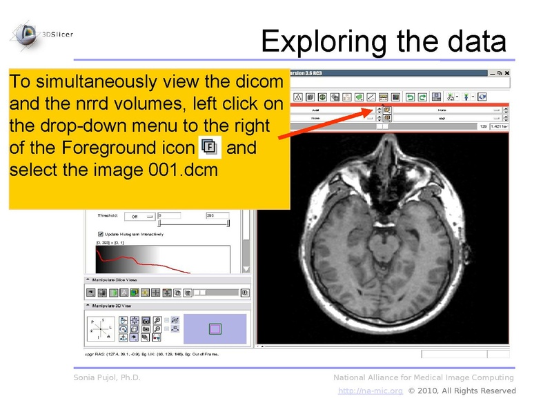File:3DDataLoadingAndVisualization Slicer3.6 SoniaPujol.pdf