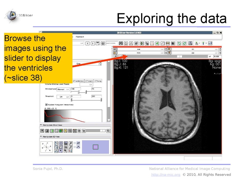 File:3DDataLoadingAndVisualization Slicer3.6 SoniaPujol.pdf