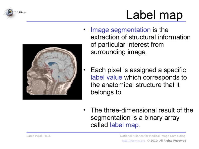 File:3DDataLoadingAndVisualization Slicer3.6 SoniaPujol.pdf