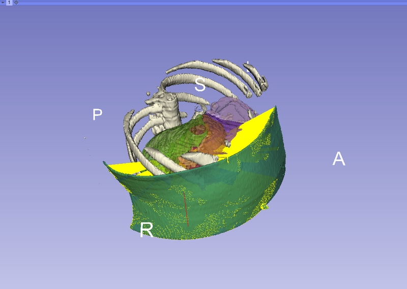 File:PercutaneousPathDesignerView10.png