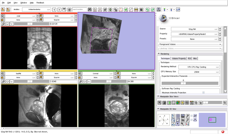 File:VtkGPURayCasting-AutoClipping-CPU.png