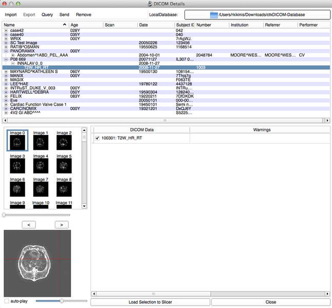 File:2012-03-04-DicomWidget.png