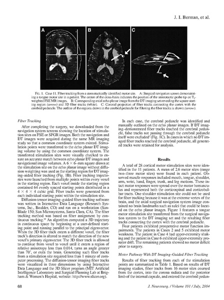 File:Berman-JNeurosurg2004.pdf