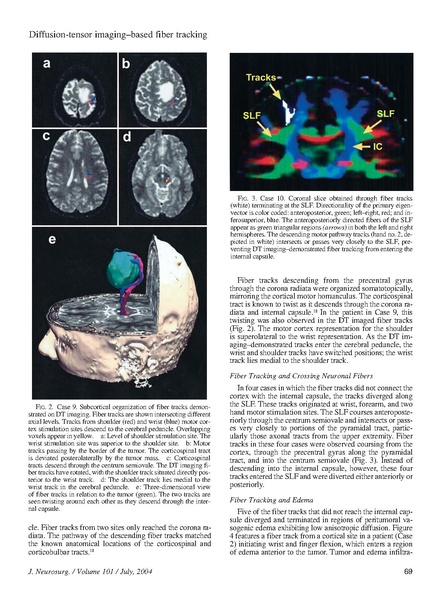 File:Berman-JNeurosurg2004.pdf