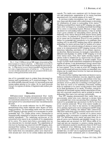 File:Berman-JNeurosurg2004.pdf
