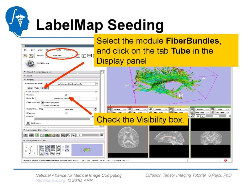 File:DiffusionMRITutorial Slicer3.6 SoniaPujol.pdf