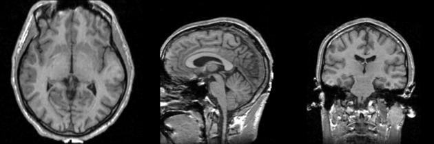 MRI-Human-Brain-T1.png