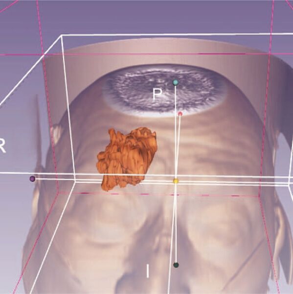 File:Qui-Medicine 2019-fig1.jpg