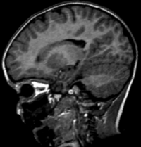 RegLib C42: pediatric MRI