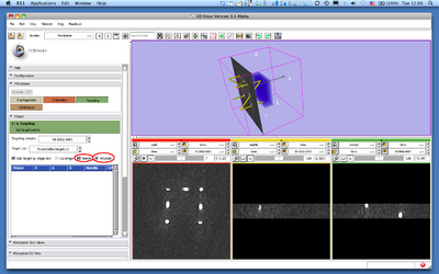 Slicer3 ProstateNav ShowNeedleAndTemplate.png