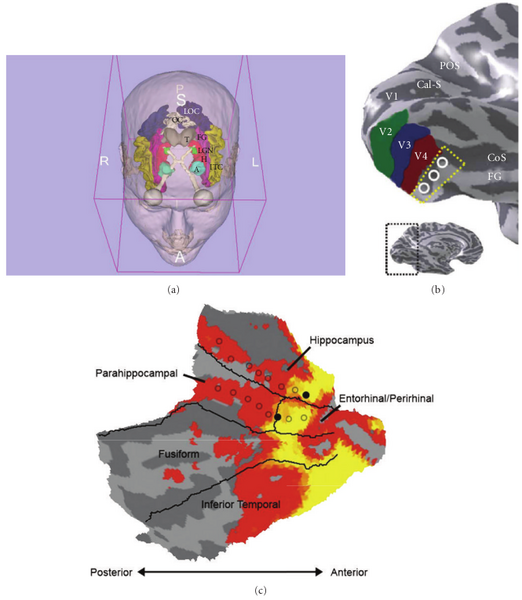 File:Fedurco-NeuralPlast2012-fig1.png