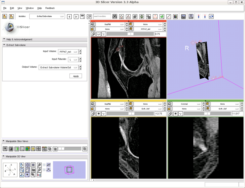 File:Slicer3.4Subvolume.png