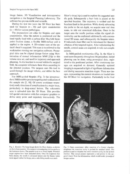 File:Nabavi-ActaNeurochir2002.pdf