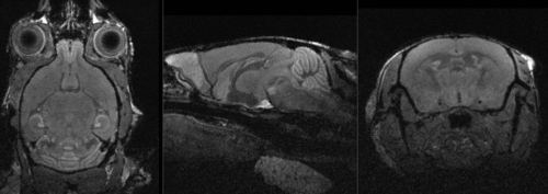 affine registered brains