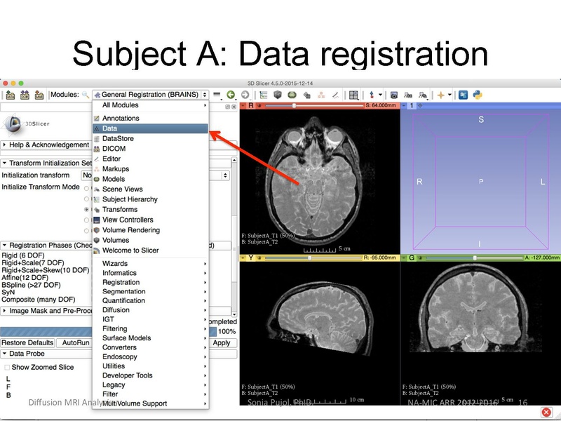 File:RegistrationTutorial 3DSlicer4.5 spujol.pdf