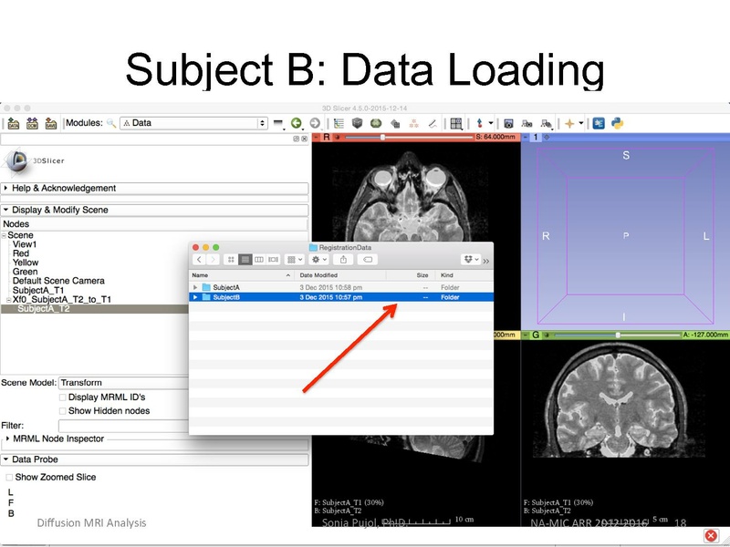 File:RegistrationTutorial 3DSlicer4.5 spujol.pdf