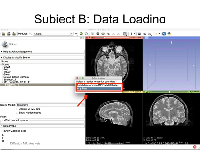 File:RegistrationTutorial 3DSlicer4.5 spujol.pdf