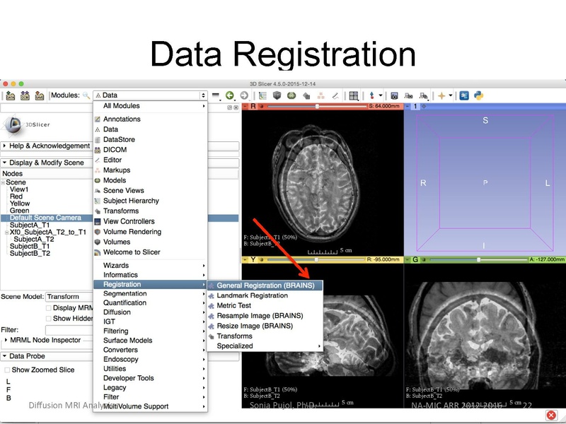 File:RegistrationTutorial 3DSlicer4.5 spujol.pdf