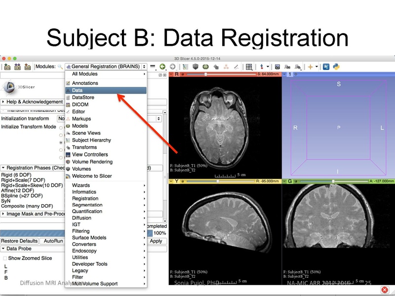 File:RegistrationTutorial 3DSlicer4.5 spujol.pdf