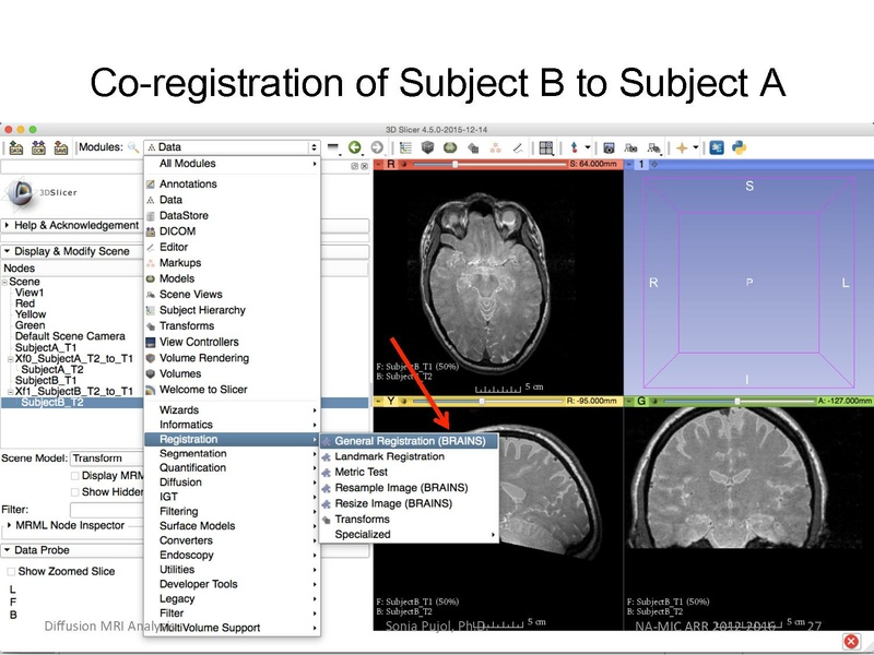 File:RegistrationTutorial 3DSlicer4.5 spujol.pdf