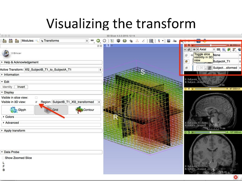 File:RegistrationTutorial 3DSlicer4.5 spujol.pdf