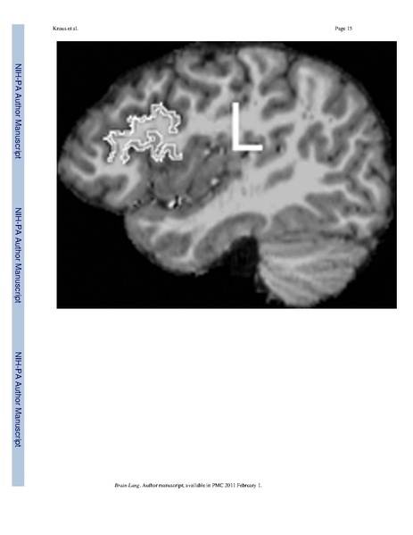 File:Knaus-BrainLang2010.pdf