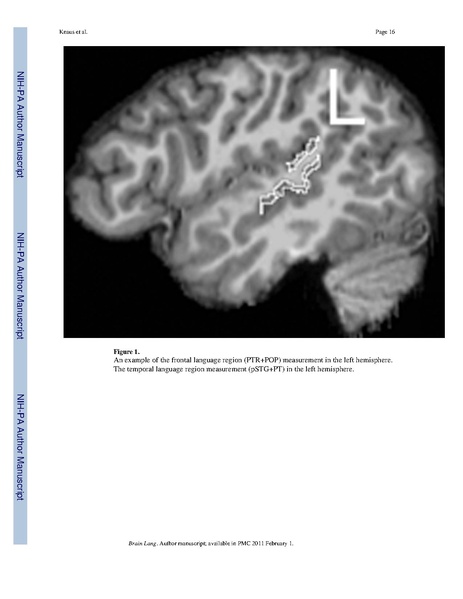 File:Knaus-BrainLang2010.pdf