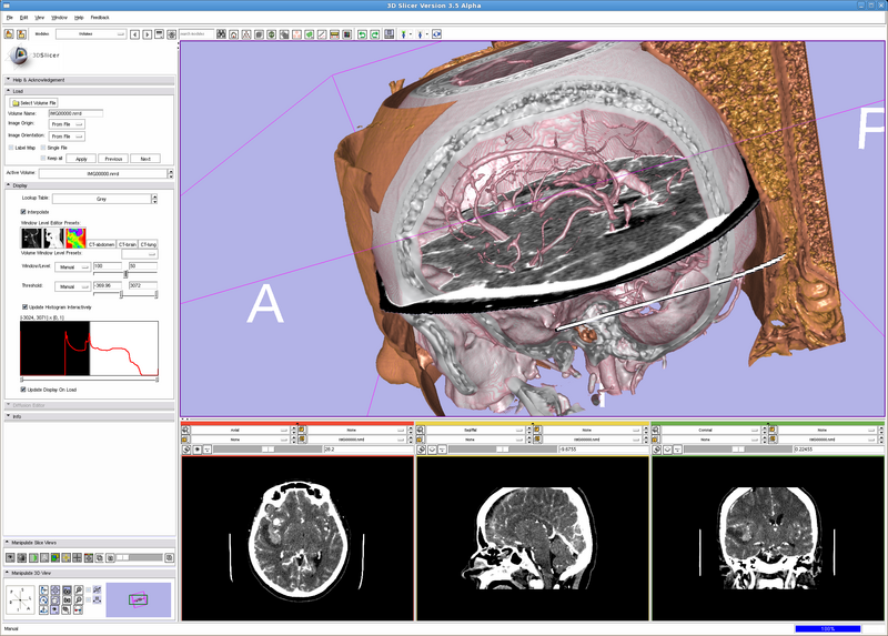 File:GPUVolumeRender1.png